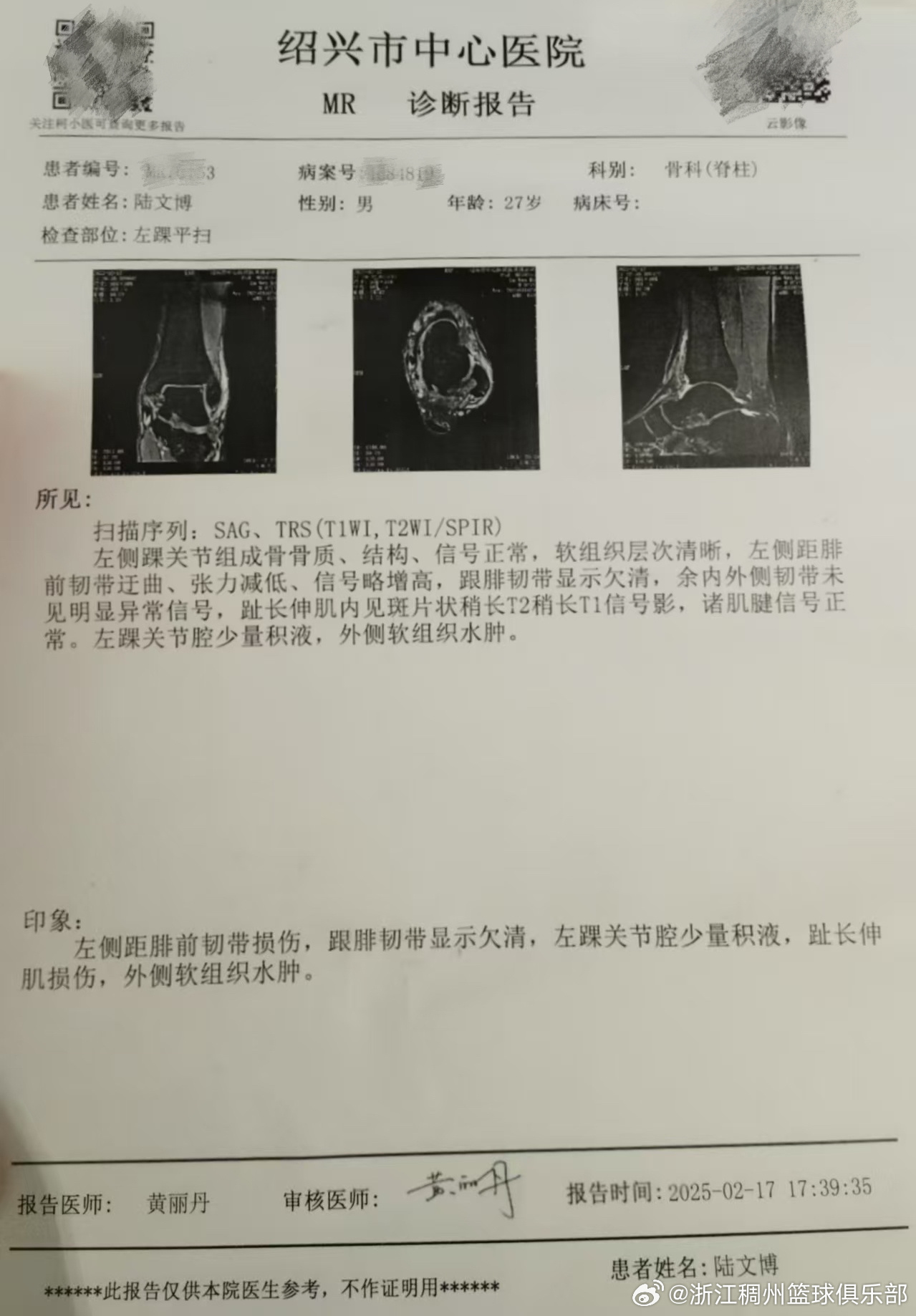 接不畅